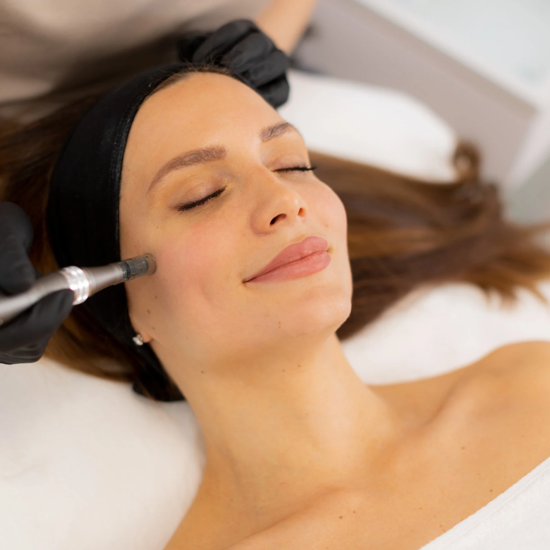 The Art of Microneedling