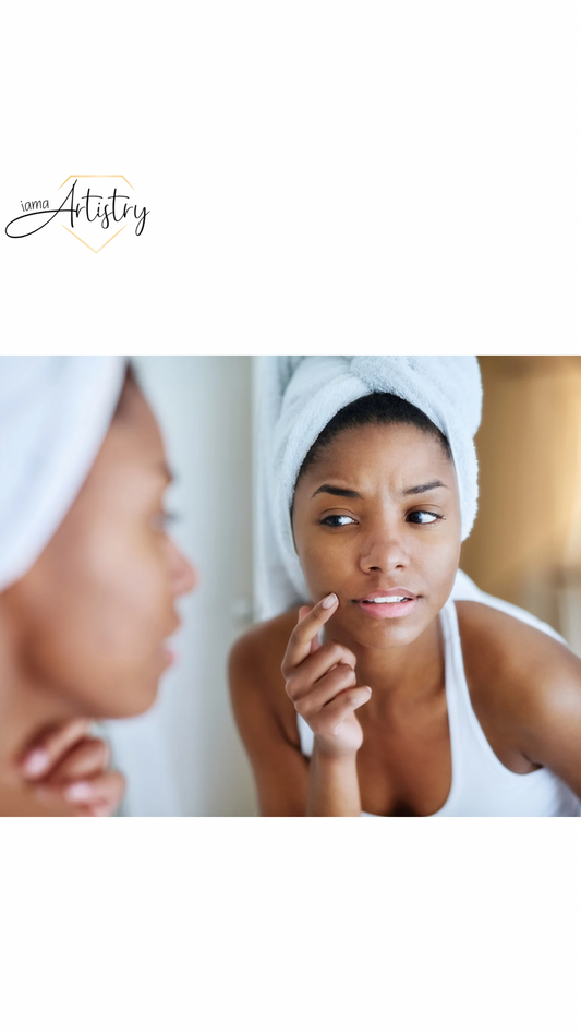 Don’t Sweat It: How to Treat Summer Acne and Heat-Induced Breakouts